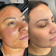 Invigorate Advanced Aesthetics