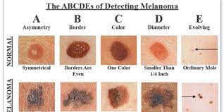 In other words, about 20% of peo. Skin Cancer Symptoms Causes And Treatment Article1000 Com
