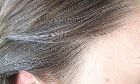 But white hair can appear at almost any time in life. What Causes White Hair At A Young Age Faculty Of Medicine