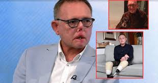 El trágico caso de Jaco Nel, el hombre que perdió piernas, dedos y parte de  su cara por lamida y arañazo de su perro