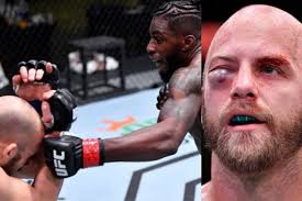 Which UFC fighter sustained serious eye injury at UFC Vegas 18
