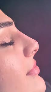 #burundolgusu #burunkorreksiyası