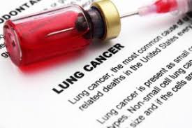 However, there are enough differences between the groups to almost consider them two different. Facts About Lung Cancer Health Beat