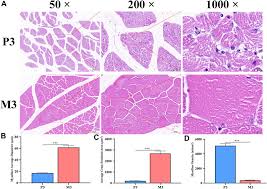 Non-coding RNA regulation of Magang geese skeletal muscle maturation via  the MAPK signaling pathway