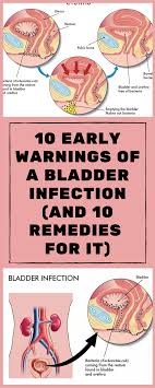 10 Early Warnings Of A Bladder Infection And 10 Remedies For It Bladder Infection Remedies Bladder Remedies