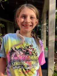 Is it the ball quality or my baby's chewing?