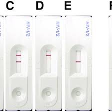 Possible Results For The Three Line Sd Bioline Hiv Rapid Diagnostic Download Scientific Diagram