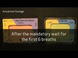 The detector attaches directly to the endotracheal tube and responds quickly to exhaled co2 by changing from purple to yellow. A New Colorimetric Co2 Detector For Verifying Correct Tracheal Intubation Youtube