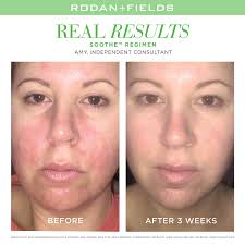 Rodan + Fields
