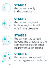 Comparing with other three single metastases, the patients with liver metastasis exhibited worst os whose mean survival was 17.529 months (p < 0.001). Myovant Sciences Focus Area Prostate Cancer