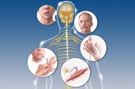 The disease causes the death of. Insights Into The Diagnosis And Management Of Amyotrophic Lateral Sclerosis Clinical Advisor