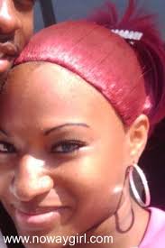 What is a receding hairline? Just Plain Fun Doobydoos Page 4