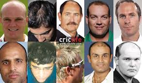 Read more and find a doctor. 10 Cricketers Who Went For Hair Transplant Cricket Country