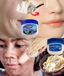 They call it mushroom debora, with just one drop you'll never suffer from  mushrooms again. See how to prepare it... more in the comment