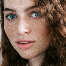 Image result for Freckled skin