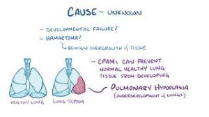 Air in the pleural space that is ideopathic in nature, however is often the result of underlying disease, termed a secondary pneumothorax. Tension Pneumothorax What Is It Causes Signs Symptoms Diagnosis Treatment And More Osmosis