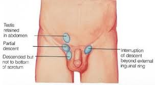 The only way to know for sure is to see you doc asap. Male Female Powerpoint Pix