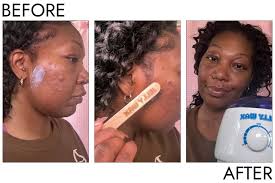 Site Loop: Person before and after using the Jelly Wax All-In-One Wax Kit