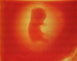 We did not find results for: Klinik Famili 9 Minggu Perbezaan Scan 2d 3d 4d 5d Facebook