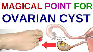 Acupressure Points For Pcos Acupressure Points For Ovary