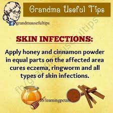 Pin On Specific Herbs And Remedies