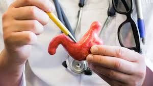 Controllable risk factors for cancer. Risk Factors For Gastroesophageal Junction Gej Cancer Sharecare