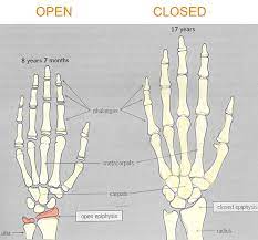 Growth Plates In Bones And Height Increase