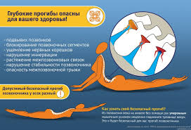 корректный подход к позвоночнику в повседневной жизни и асанах йоги Glubokie Progiby Opasny Dlya Zdorovya Kpp Blog