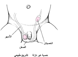 الخ صي ة غ ير النازلة والخصية القافزة قضايا صح ة الأطفال دليل Msd الإرشادي إصدار الم ستخد م