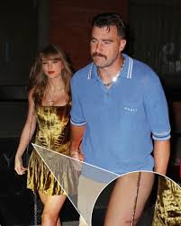 Fans have recently spotted Taylor Swift's noticeable burn injury in photos  taken with Travis Kelce. Read more: https://g2w2.short.gy/OZeK88Nom