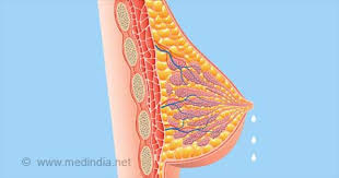 Image result for Galactorrhea