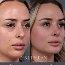 Discover Expert Plastic Surgery in Fort Worth, TX