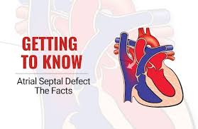 Image result for Atrial Septal Defect