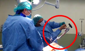 He also branched out into acting. Surgeon Video Using A Hammer To Get Metal Rod Out Of Patients Shin Bone Daily Mail Online