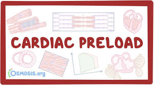 Image result for Preload