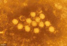 The site owner hides the web page description. å¼•èµ·å¿ƒè‚Œç‚Žçš„åŽŸå› æ˜¯ä»€ä¹ˆå'¢ åˆæœ‰ä»€ä¹ˆç—…ç—‡å'¢ æ¯æ—¥å¤´æ¡