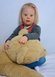 Downsyndromberlin Down Syndrom