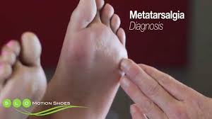 Runners, models and even ordinary people often experience pain in their feet after activity. 10 Best Metatarsal Pads To Cure Your Foot Pain In 2021 Test10best
