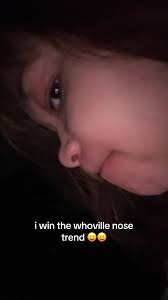 Whoville Nose Trend: A Fun and Creative Challenge