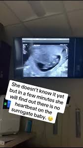 fyp #fy #tiktok #foryoupage #