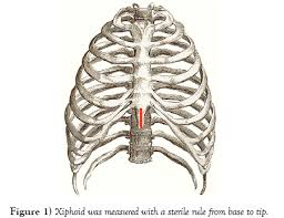 Xiphoid Size and Gender Differences: An Anatomical Study