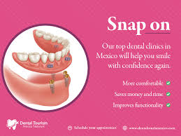 Snap On Dentures In Tijuana Mexico Dental Crowns Dental Dental Clinic