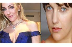Maybe you would like to learn more about one of these? Meryem Uzerli Estetik Yaptirdi Fiskos Haberleri