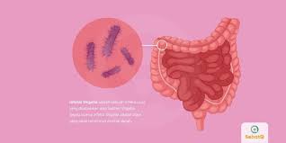 Infeksi Shigella Atau Shigellosis Adalah Infeksi Usus Yang Disebabkan Bakteri Gejala Penyakit Ini Serupa Dengan Disentri Yaitu Diare Atau Penyakit Popok Darah
