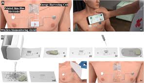We did not find results for: Fully Untethered Battery Free Biomonitoring Electronic Tattoo With Wireless Energy Harvesting Scientific Reports
