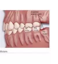 It took approximately six months to really get that innervation back. How Long Is The Recovery Time After Wisdom Teeth Removal Quora