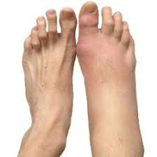 Pin On Natural Joint Pain Relief
