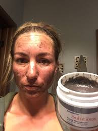 I have dermatillomania (skin picking), with the majority of it