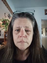 Oculus Quest 2 lens protection and prescription options