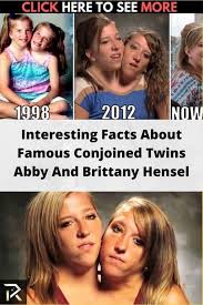 Interesting Facts About Famous Conjoined Twins Abby And Brittany Hensel In 2020 Fun Facts Funny Moments Super Funny